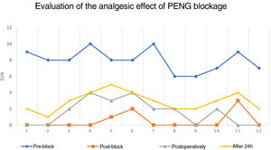 Evolution of pain experienced according to the VNS for each of the 12 patients included in the study, at four different times (before the block was performed, 30min after the block was performed, in the immediate postoperative period and 24h after surgery).