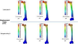 Map of the global displacement values at the femoral head for the osteosyntheses analysed.