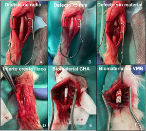 Imágenes intraoperatorias de la intervención sobre radio de conejo. A) Exposicón de la diáfisis de hueso radio. B) Planificación del defecto a crear de 15 mm. C) Exposición del defecto sin material (G1). D) Defecto relleno con autoinjerto de cresta iliaca del propio animal (G2). E) Defecto relleno con soporte de CHA (G3). F) Defecto relleno con soporte de VMB (G4).
