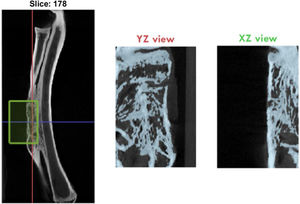Image of the selection of the defect to be studied in the micro-CT study and visualisation of the same in the different planes of space to adjust the work area.