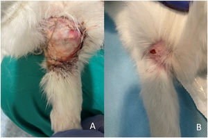 Images corresponding to a postoperative infection in the operated limb. (A) Wound appearance 10 days after surgery. (B) Wound appearance 24 days after surgery after lavage, surgical debridement and antibiotic therapy.