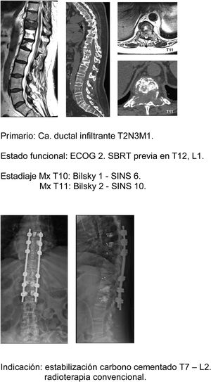 Caso clínico SINS 7-12.