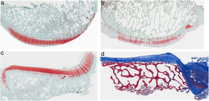 Histología del grupo sin resección de la grasa de Hoffa, a) #1 cóndilo femoral con una estructura normal y mantenimiento de proteoglicanos; b) #5 cóndilo femoral con pérdida de la estructura tisular y disminución de proteoglicanos; c) #2 cóndilo tibial con estructura normal; d) #3 cóndilo tibial con grupos isogénicos, desestructuración del tejido cartilaginoso y disminución de proteoglicanos.