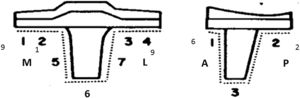 Frecuencia y distribución de las líneas radiolúcidas en la serie. M: medial; L: lateral; A: anterior; P: posterior.