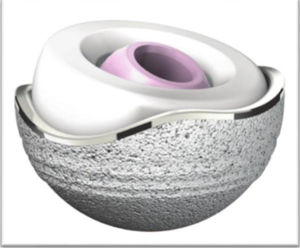 Diagram of dual mobility component.6