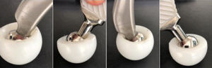 Mobility and adduction and abduction of the two systems. Quattro™ and Dualis™, respectively.
