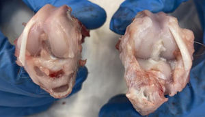 Conejo 4 grupo II (osteoartritis AH comercial).