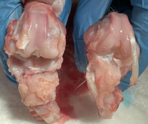 Conejo 5 grupo III (osteoartritis con AH y NP vacías).