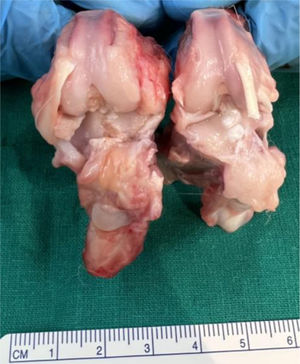 Rabbit 1 group V (osteoarthritis, treatment with HA with curcumen).