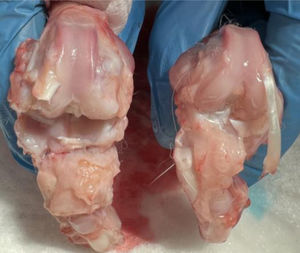 Rabbit 5 group III (osteoarthritis with HA and empty NPs).