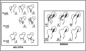 Clasificaciones y distribución de AO/OTA y Singh.