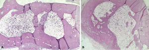Hematoxilina-eosina 4×: cierre cortical completo en pata control (A) y caso (B).