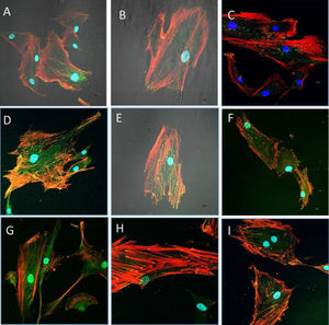 HOB® osteoblasts cultured in the CS10G4 sample after 48h (A and B), 72h (D and E), and 1 week (G and H) in culture and examined with a confocal microscope (40×). Osteoblasts cultured on glass were used as a reference control, shown in (C), for 48h in culture (F), after 72h in culture and (I) after 1 week. In red, actin cytoskeletal fibres immunolabelled with rhodamine phalloidin show the polarisation of the material and the arrangement of the actin cytoskeleton in tension fibres. Focal adhesions (yellow) were immunolabelled with anti-vinculin antibody. Nuclei (blue) were labelled with DAPI.