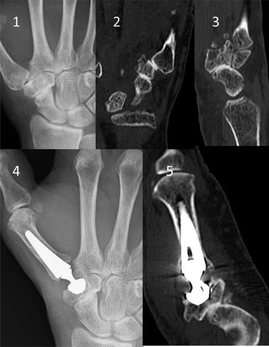 fig0005