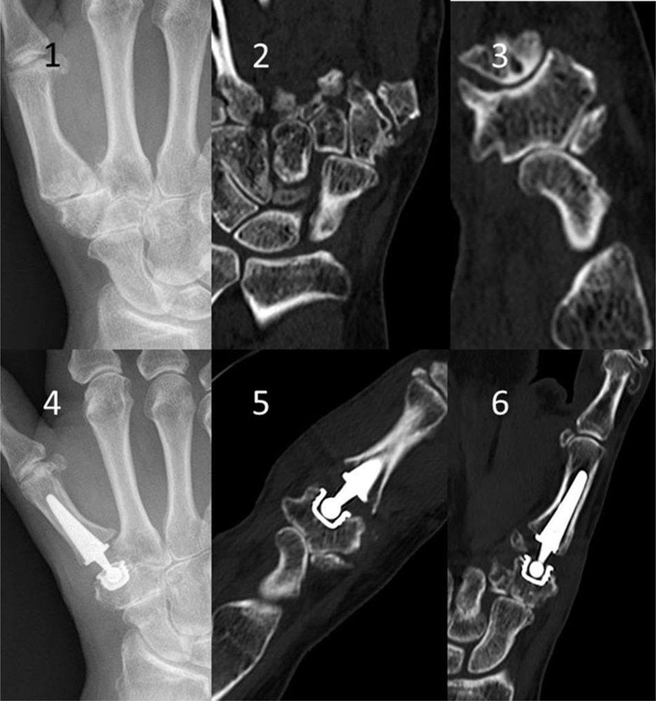 fig0010