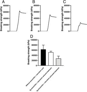 Records of the compressive force applied until breakage of the pieces of model A, printed with 10g of Optiprint® Lumina resin, (A) in the absence (without Amox+Clav) or in the presence of 2g of amoxicillin–clavulanic acid; (B) before (2g Amox+Clav pre) and (C) after (2g Amox+Clav post) of drug elution. (D) Mean values and standard deviation of the breaking strength of the pieces of model A under the different experimental conditions.