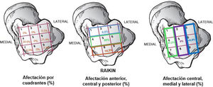 Estadística descriptiva de la lesión osteocondral y su localización atendiendo a la clasificación topográfica de Raikin; afectación en cuadrantes anteriores, centrales y posteriores; afectación en cuadrantes centrales, mediales o laterales.