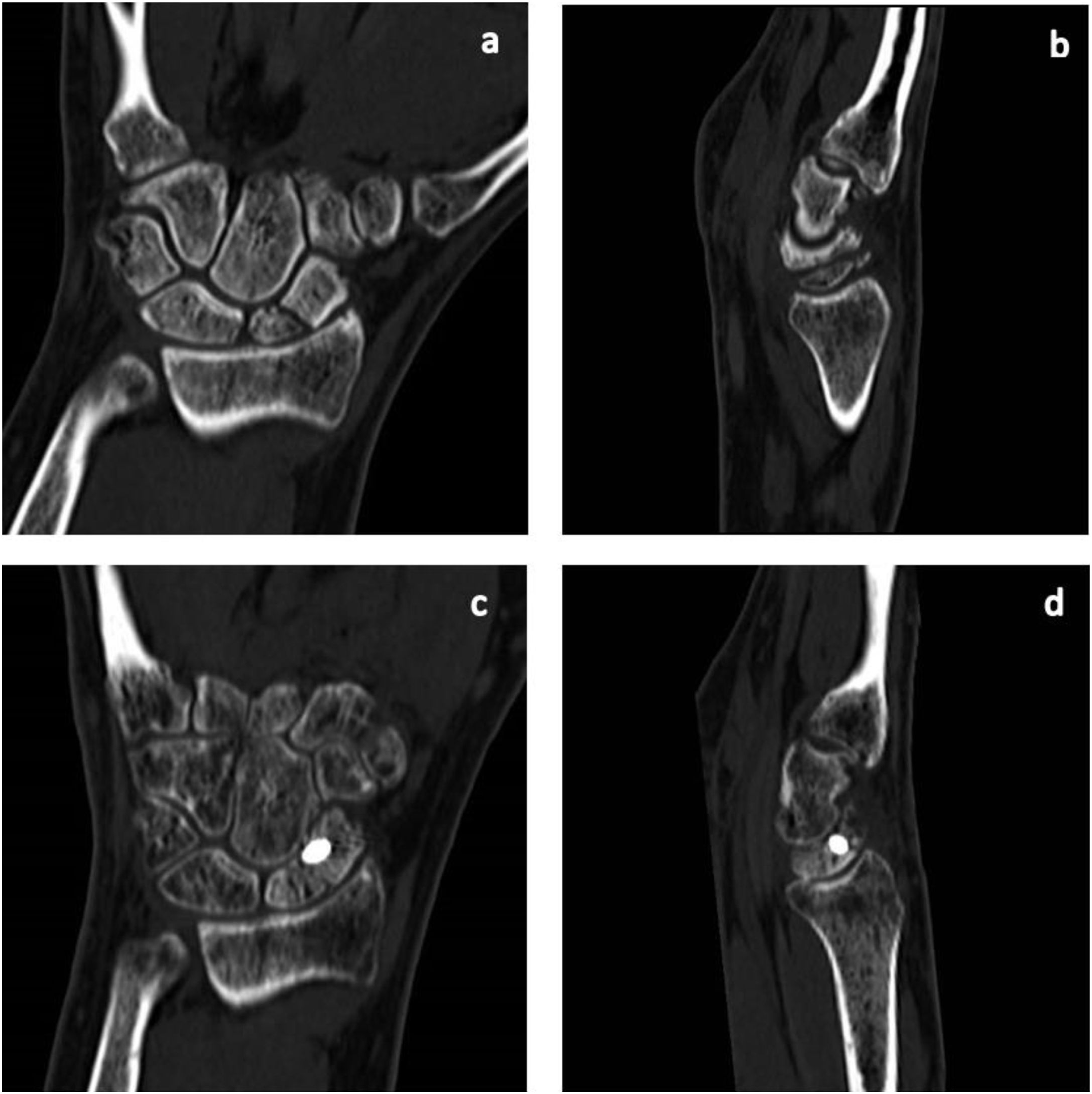 fig0005