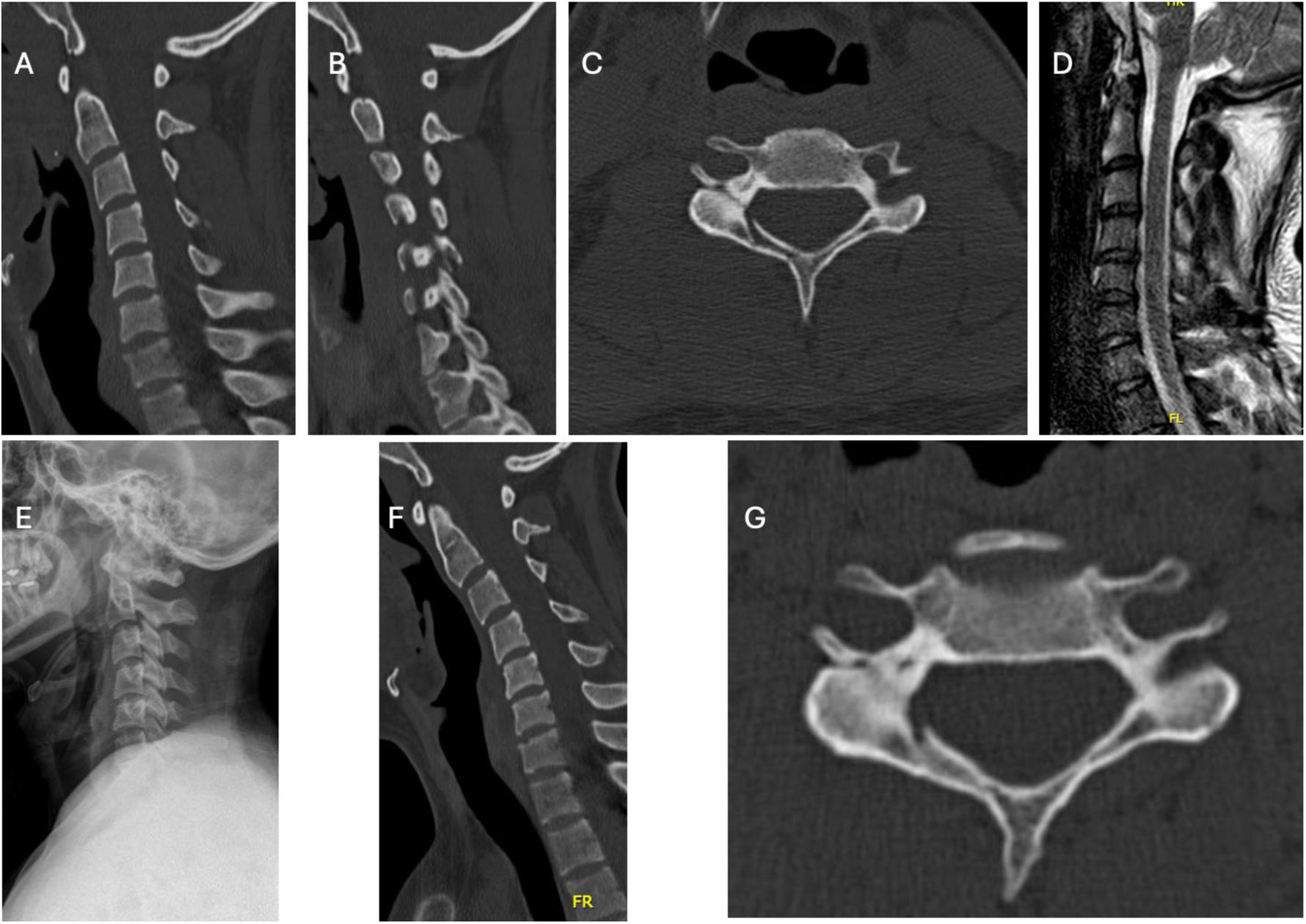 fig0005