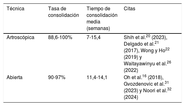 Tablas
