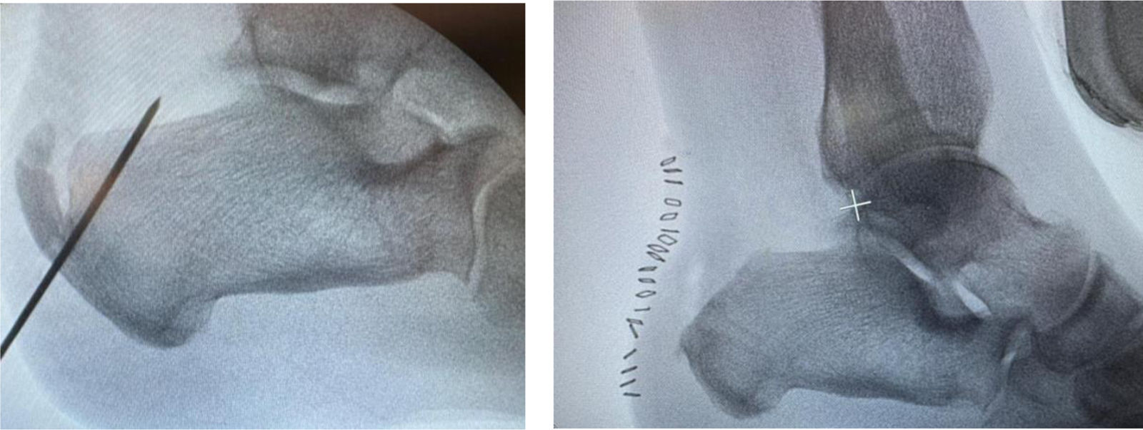 fig0010