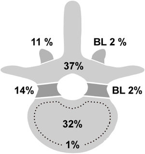 Vertebral injury distribution: lamina 57 (37%); vertebral body 134 (32%); pedicle 59 (14%); facet 48 (11%); bilateral (BL) facet 7 (2%); bilateral pedicle 10 (2%); intervertebral disk 1 (1%).