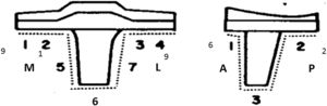 Frecuencia y distribución de las líneas radiolúcidas en la serie. M: medial; L: lateral; A: anterior; P: posterior.