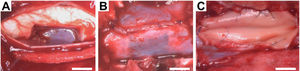Intraoperative photographs of the surgical procedures. (A) Cavity resulting from excision of 1cm length of the right side of the C6 spinal cord segment. (B) Dural reconstructive microsurgery with continuous suturing. (C) Application of hyaluronic acid to the spinal cord defect and spinal dural patch with bovine pericardium and continuous suture. Scale bar, 5mm.