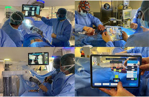 Aplicación de las nuevas tecnologías, como la asistencia robótica o la navegación, en la cirugía de columna.