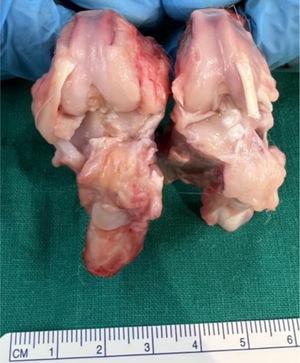 Conejo 1 gupo V (osteoartritis tratamiento con AH con curcumina).