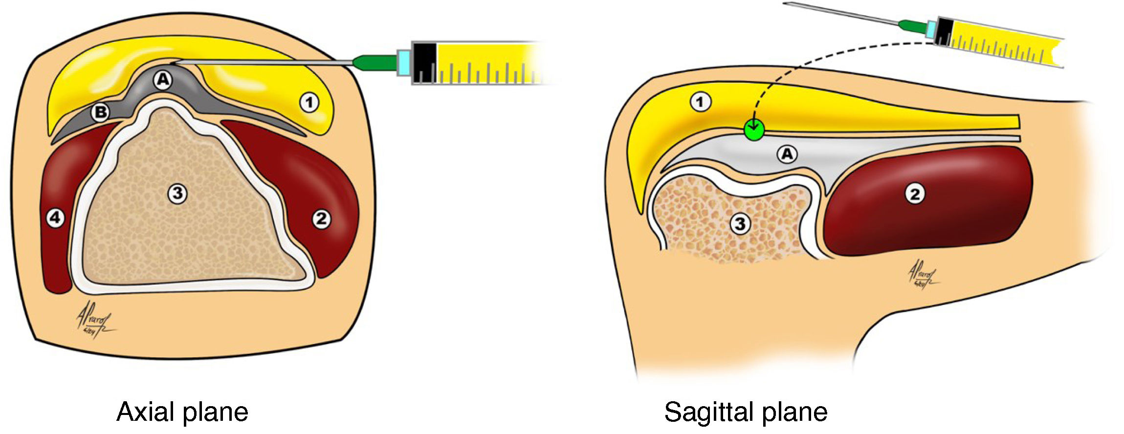 fig0005