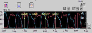 Registro máximo de presiones máximas de pie derecho (rojo [gris claro]) e izquierdo (azul [gris oscuro]). Muestra los marcadores de los puntos de inicio y finalización del análisis.