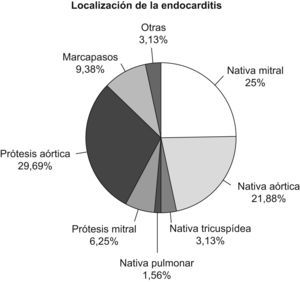 Distribución de porcentajes de localización de endocarditis infecciosa.