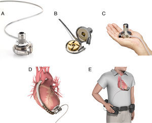 En la composición de imágenes del dispositivo de asistencia ventricular izquierda de tercera generación HAVDTM se aprecia la estructura externa e interna de la bomba (A y B, respectivamente), su reducido tamaño (C), la disposición tras el implante en relación al ápex del ventrículo izquierdo y la raíz aórtica (D) y, por último, una representación gráfica de la configuración final tras ser conectado a la fuente de alimentación portátil externa (E).