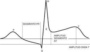 La imagen muestra la representación de los distintos segmentos electrocardiográficos y de la línea de base (segmento TP) utilizada para la medición de la elevación del segmento ST y la amplitud de la onda T.
