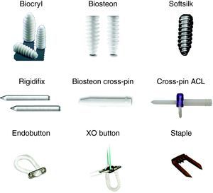Drawings of the different types of fixation analysed.