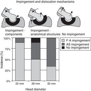 Femoro-pelvic impingement as causative mechanism of dislocation. With a 22-mm head, the impingement occurs between the femoral neck and the edge of the acetabular component, while with a 32-mm head, the impingement is between the anatomical structures.