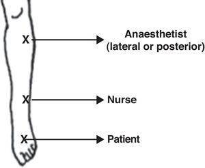 Diagram showing the different marks drawn on the foot to be operated.