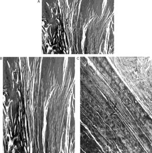 Histological cuts of the graft in the joint space. (A) (Masson trichrome, ×4), (B) graft and synovial that envelops it (Masson trichrome, ×4) and (C) vessels running longitudinally along the graft (Masson trichrome, ×10).