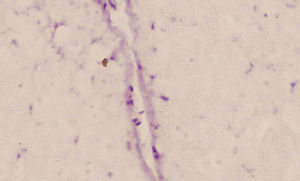Image of an isolated stem cell labelled with BrdU in a rabbit from the group treated with ATSC (×10).
