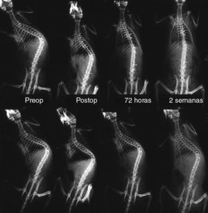 Comparative, serial dorsoventral radiographs between the nitinol group (top) and the control group (bottom), before implantation of the nitinol wire, in the immediate postoperative period, at 72h and 2 weeks after surgery. Note the gradual correction of scoliosis in the nitinol group throughout the 2 weeks of treatment. In comparison, in the control group there is an initial reduction of the deformity, which then remains stable during follow-up.