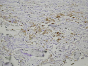 PDGFA staining in osteoblasts at 7 days after fracture.