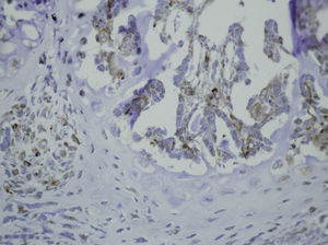 PDGFA staining in osteoblasts at 15 days after fracture.