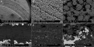 Images of the wear tracks obtained by electron microscope. In the upper images (A–C) abrasive wear can be seen in contrast to that obtained in the lower images (D–F). Note the particles adhered to the surface in E and (in a larger scale) in Image F.