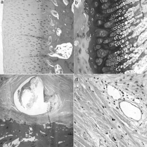 Histology at 12 weeks after the intervention. (a) No significant differences were observed in the histological structure of articular cartilage between operated and control animals (H&E, ×4). (b) The area of physeal proliferation and differentiation was reduced in control animals, due to premature ossification thereof (H&E, ×10). (c) The periosteum presents a fibrotic reaction around the suture which does not collapse the blood vessels of the deep layer (H&E, ×2). (d) No vascular changes in the areas of periosteal reaction (H&E, ×10).