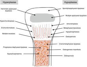 Rubin classification. It distinguishes between bone dysplasias according to the affected area of the bone, marking whether they are hypo- or hyperplasias.