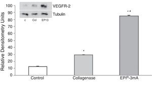 Histogram of the analysis of VEGFR-2 protein. Mean±standard deviation expressed in relative densitometry units. The asterisk determines significance when comparing with the control group, and the hash when comparing with the collagenase group.