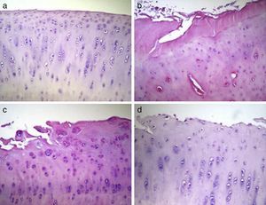 Histological analysis of cartilage 12 weeks after the intervention. The data shown represent 4 sections (20×) per animal. (a) Group 1 or normal (n=12); (b) Group 2 or injured untreated (n=6); (c) Group 3 or single dose of Hylan G-F 20 (n=6); (d) Group 4 or 3 doses of Hylan G-F 20 (n=6).