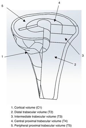 3D schematic of the different bone volumes studied.