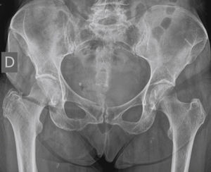 Conventional radiography image in an anteroposterior projection.